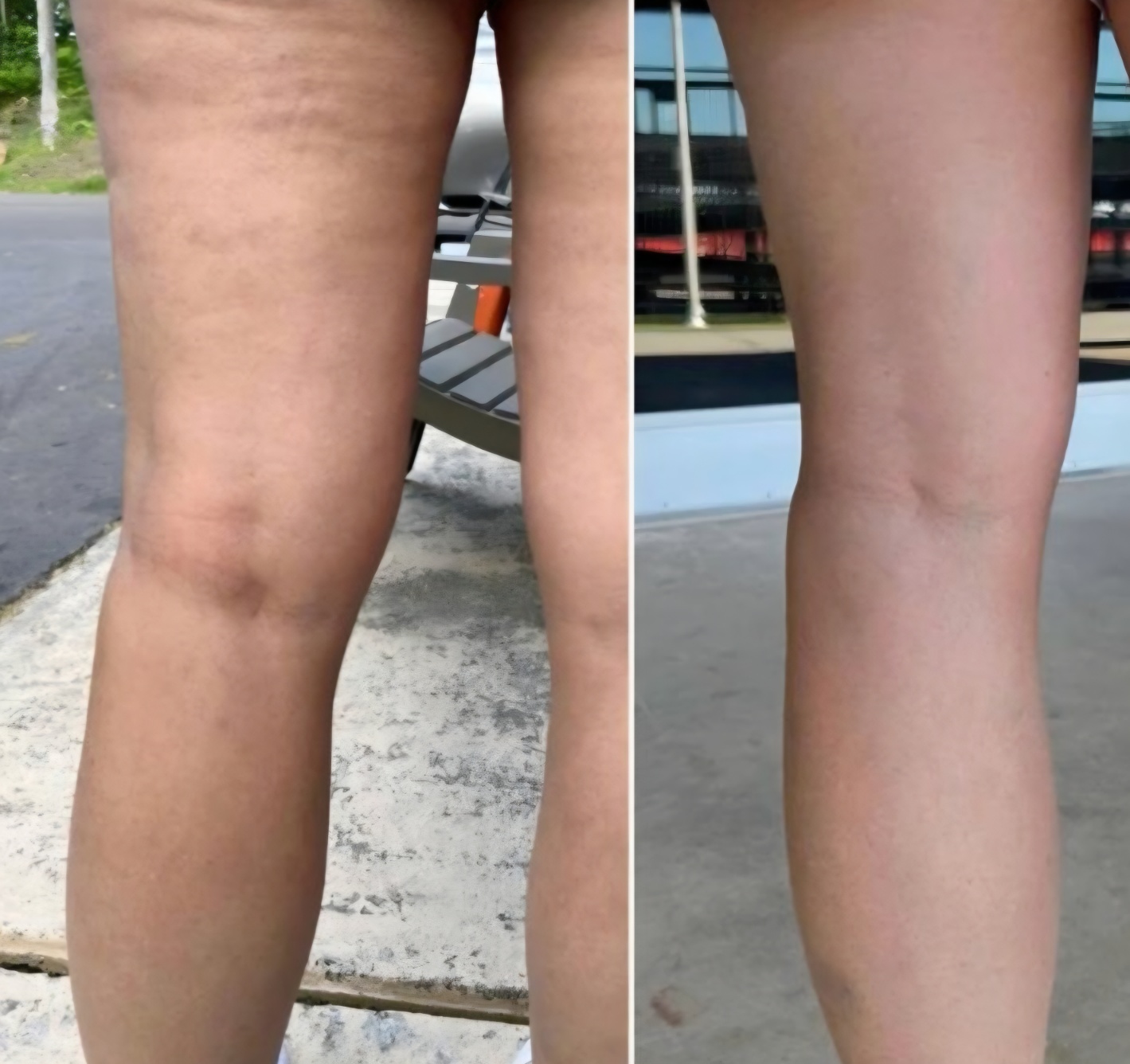 스키니바디 토탈뷰티 대표 이미지