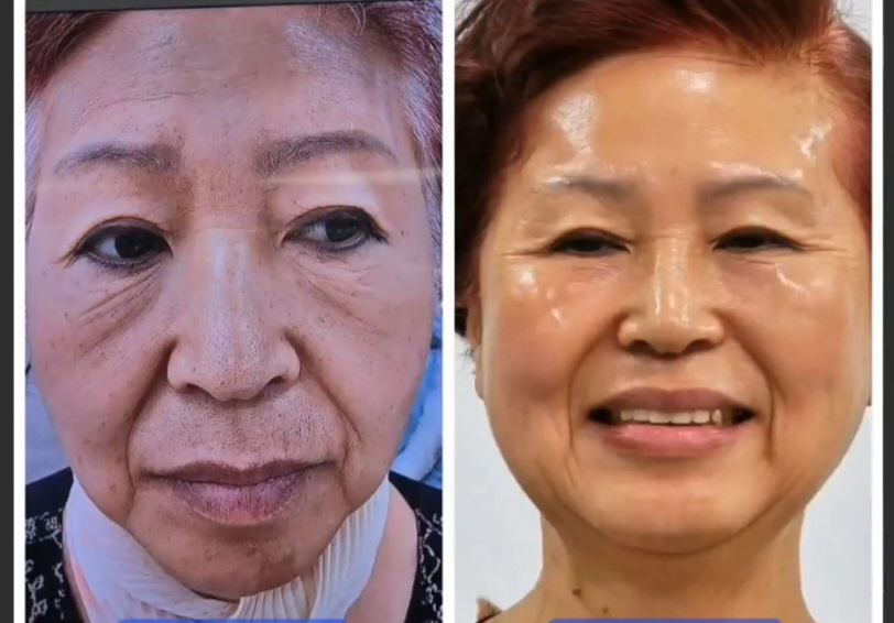 인셀덤광주 드림위더스
