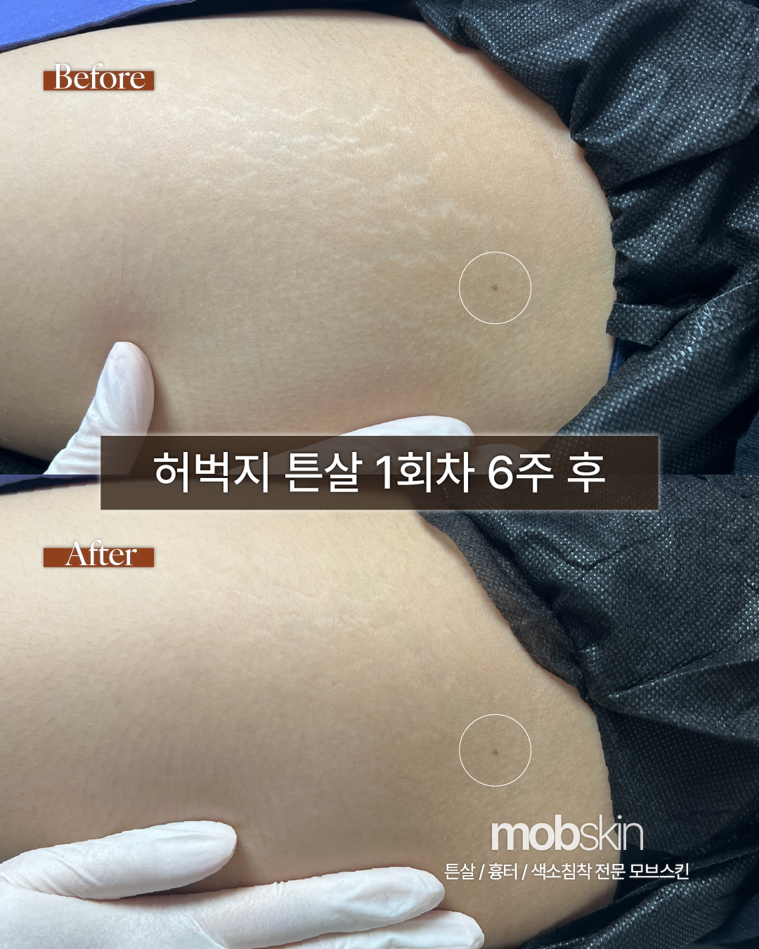 모브스킨 대표 이미지