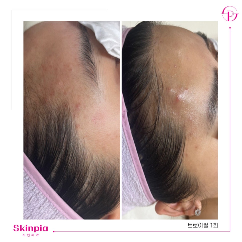 스킨피아 대표 이미지