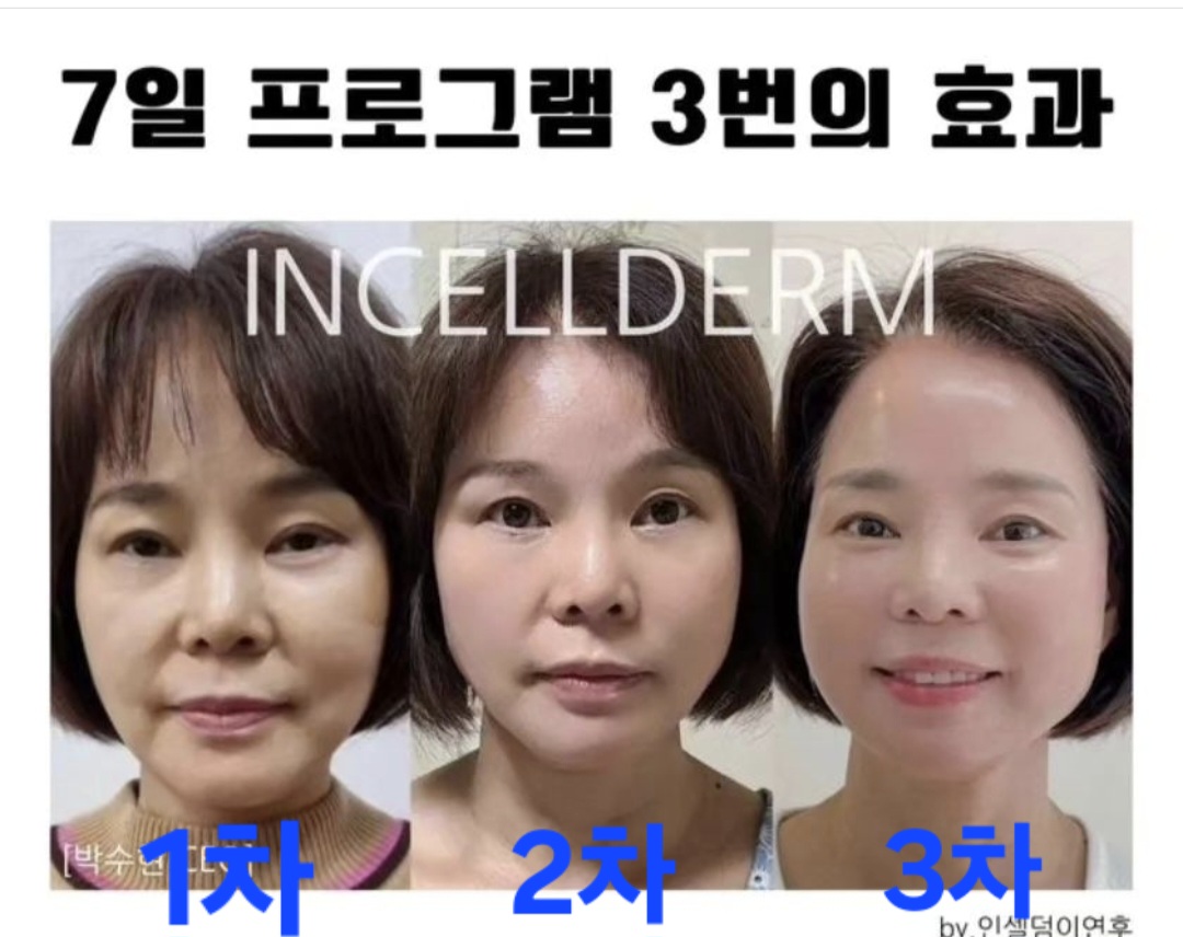 인셀덤광주 드림위더스