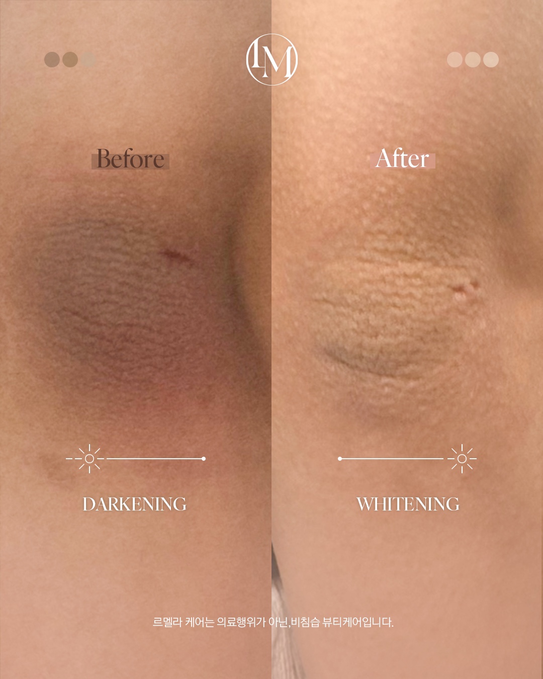 모브스킨 대표 이미지