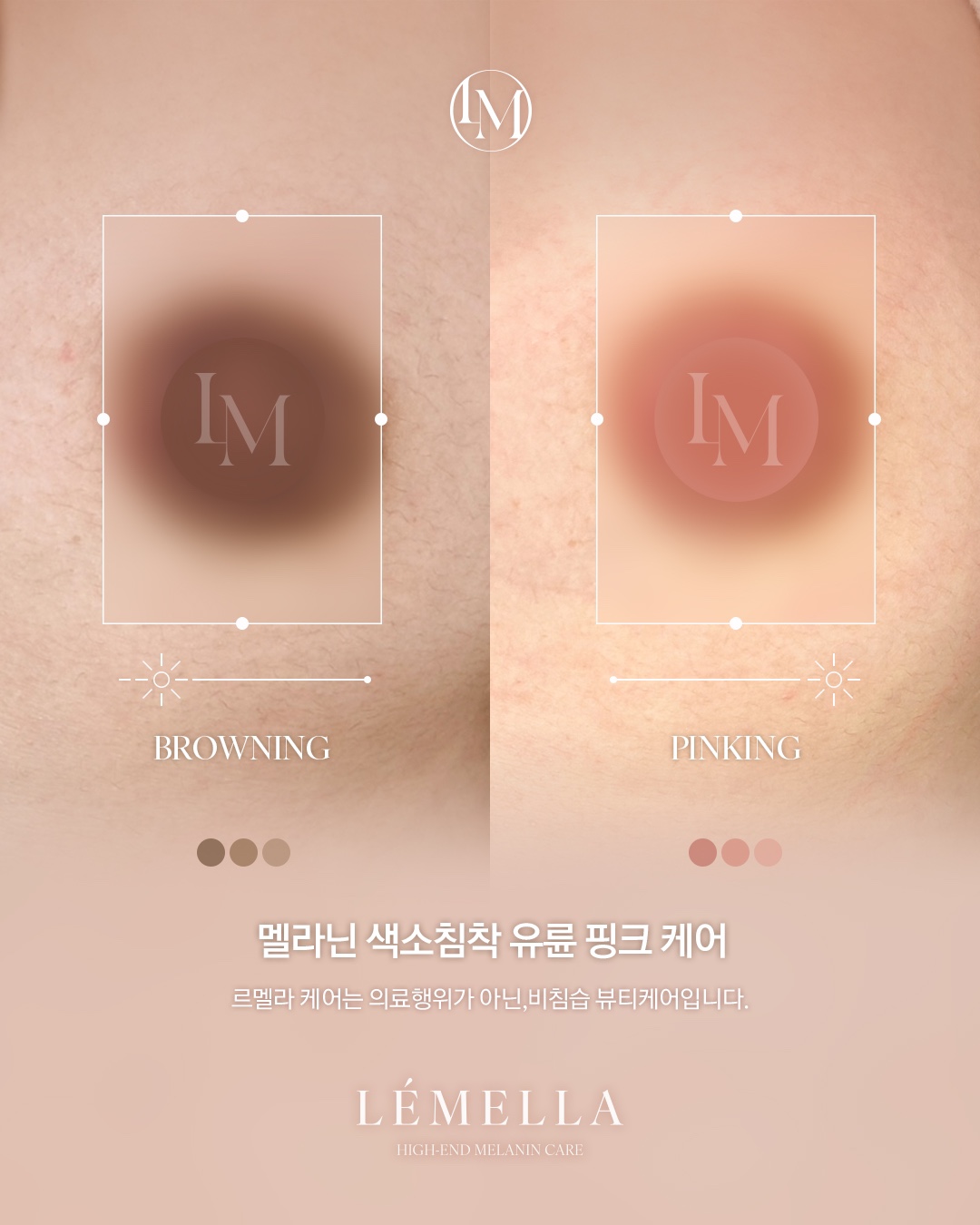 모브스킨 대표 이미지