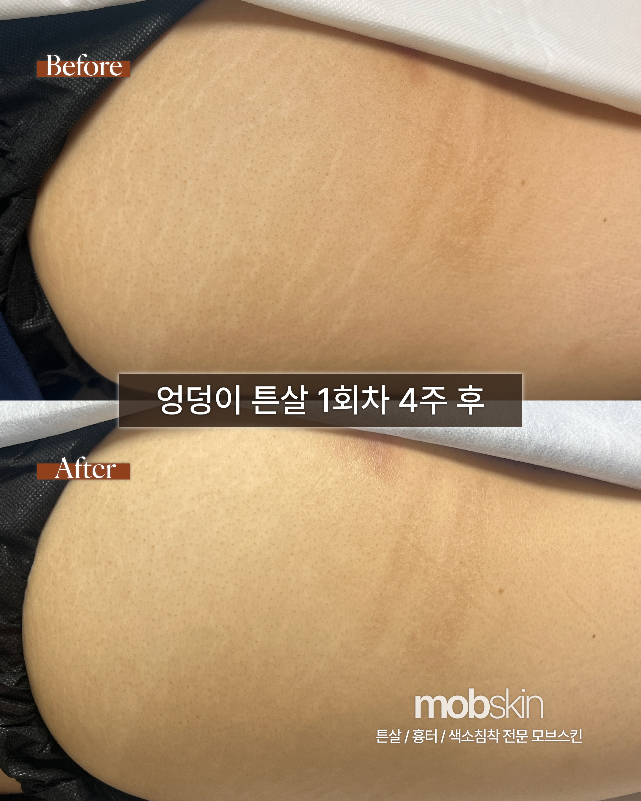 모브스킨 대표 이미지