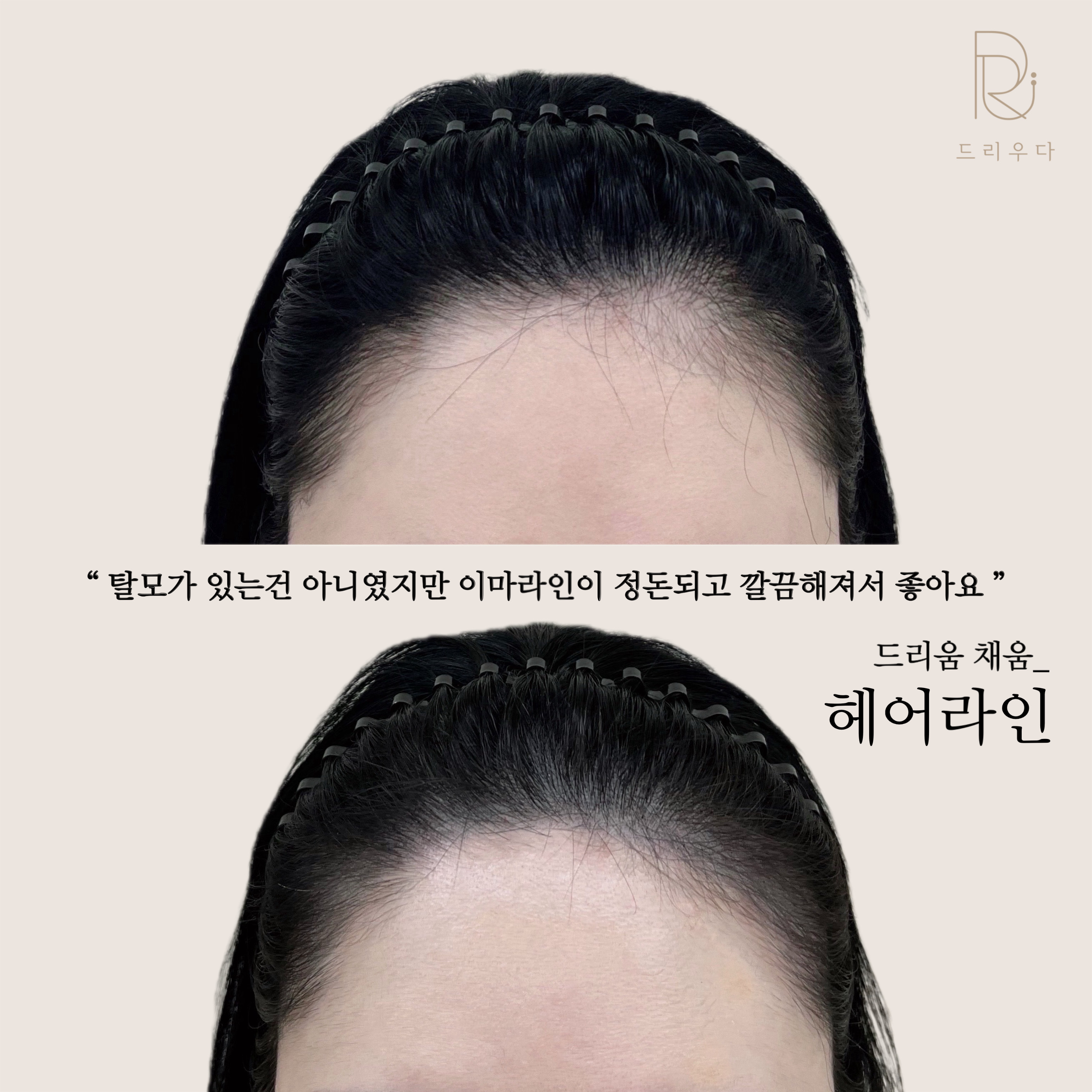 드리우다 대표 이미지