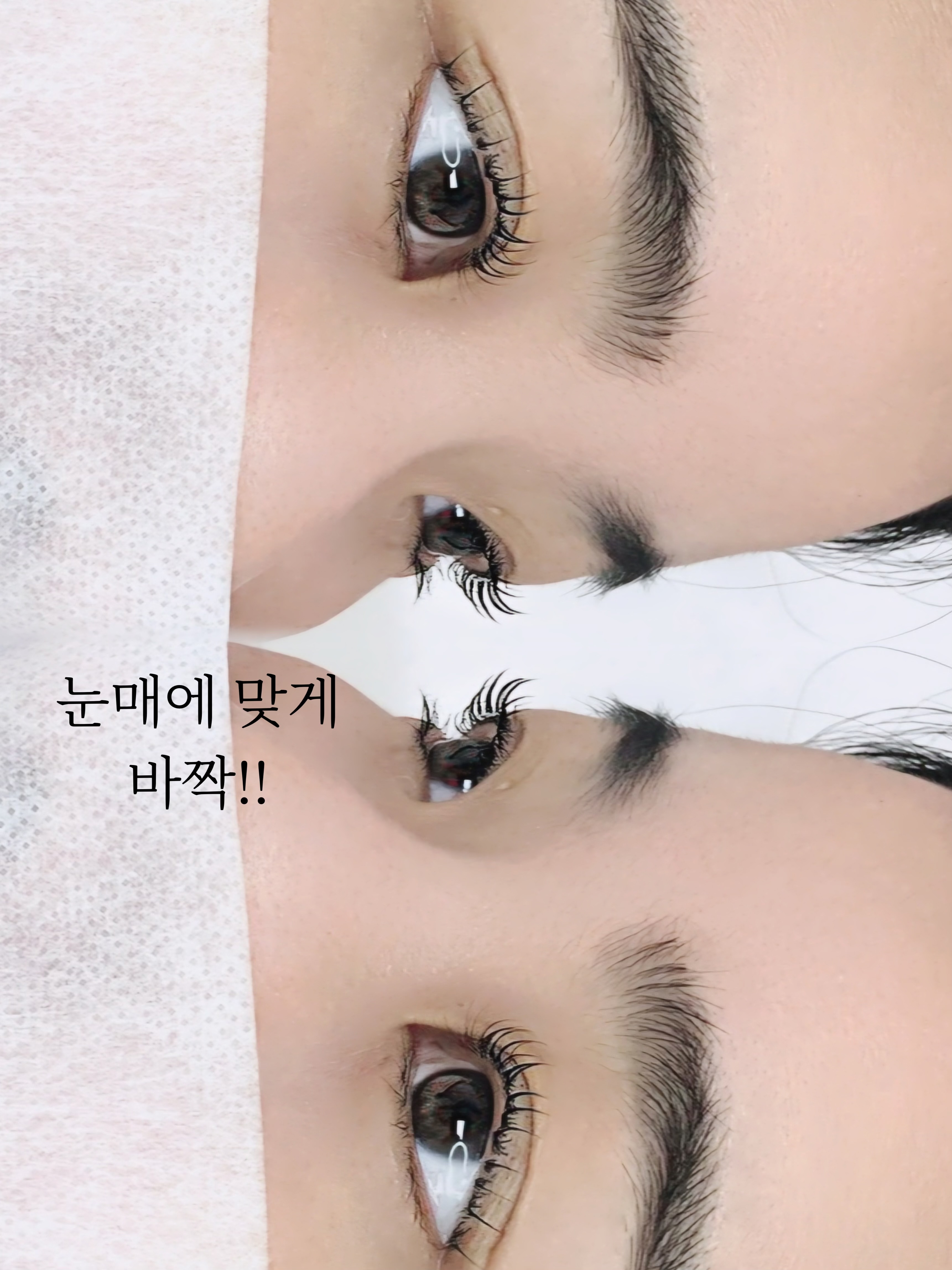 래쉬올린 대표 이미지