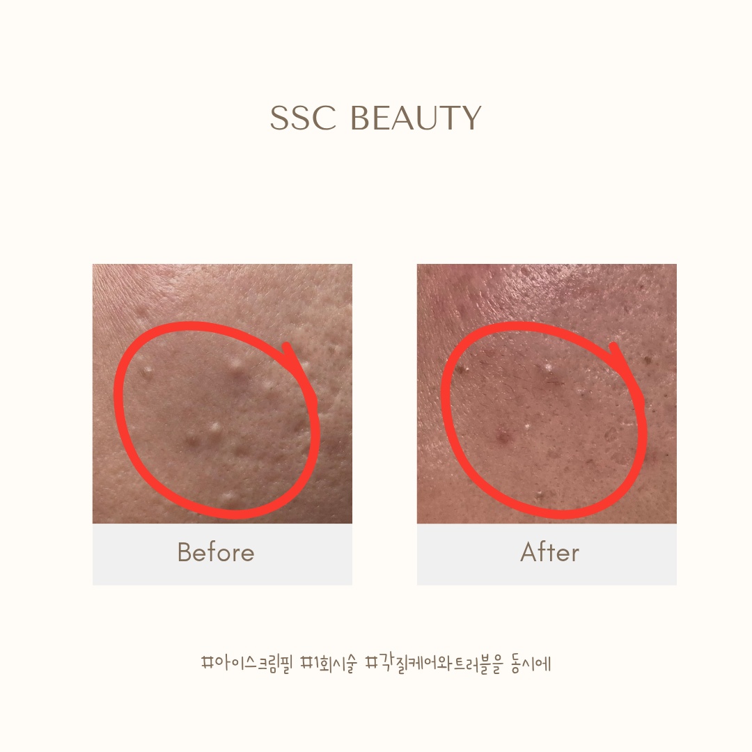 SSC 뷰티