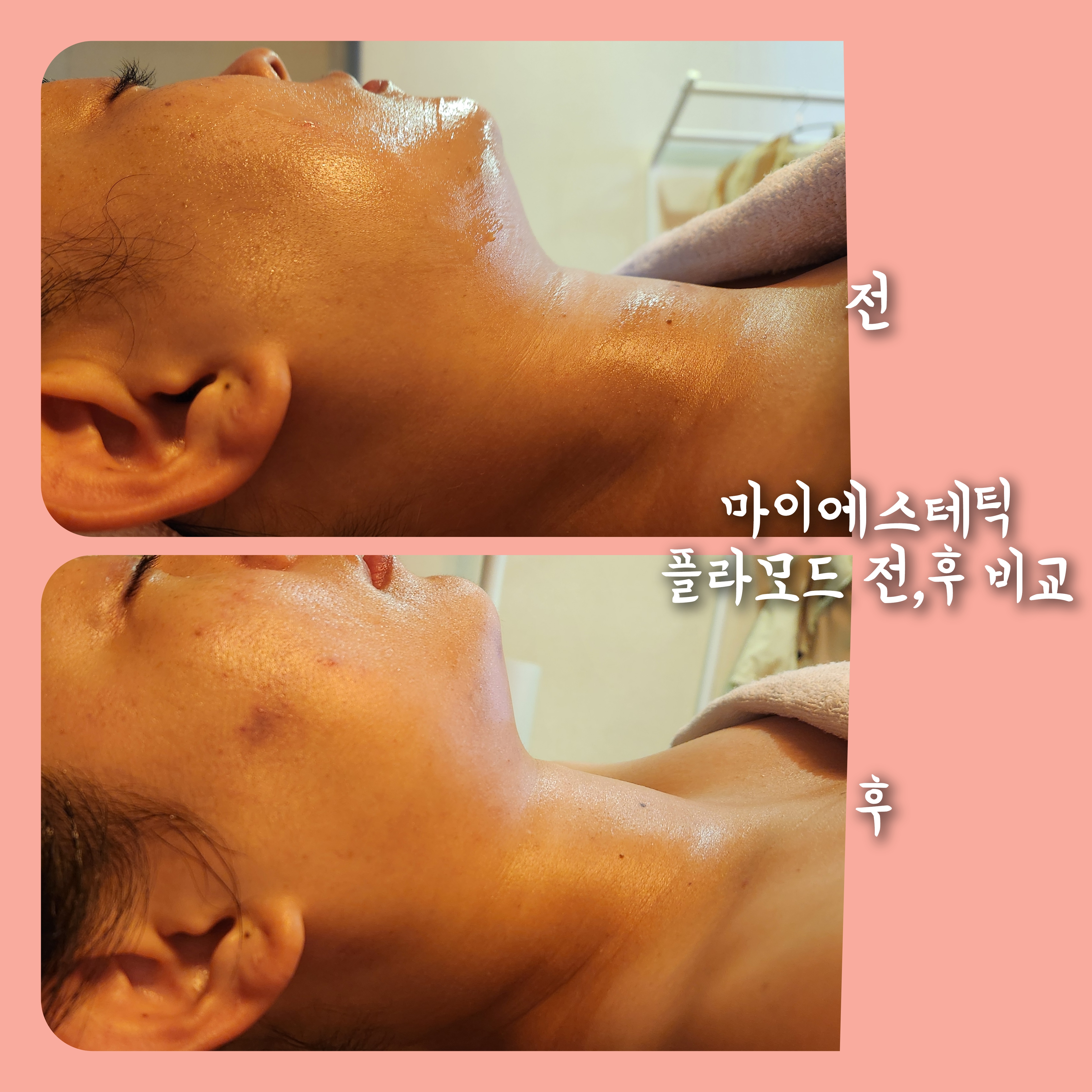 마이에스테틱