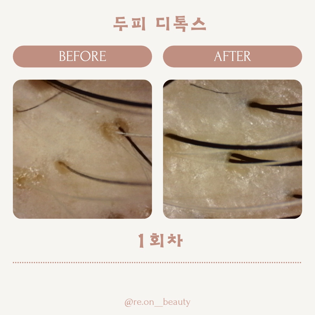 올가드림뷰티 천호점 대표 이미지