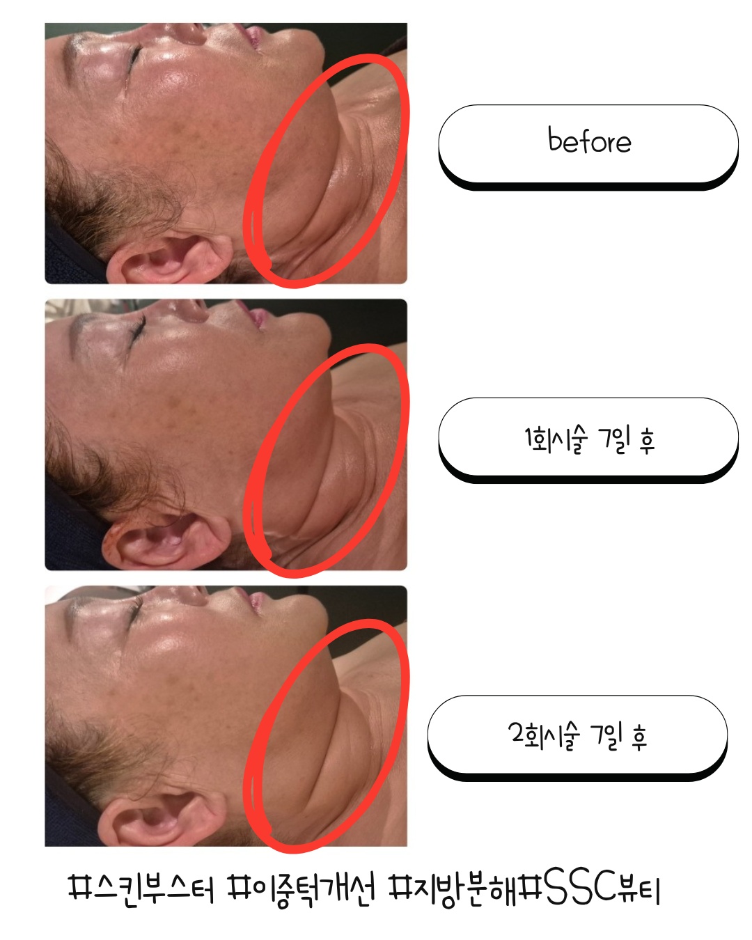 SSC 뷰티