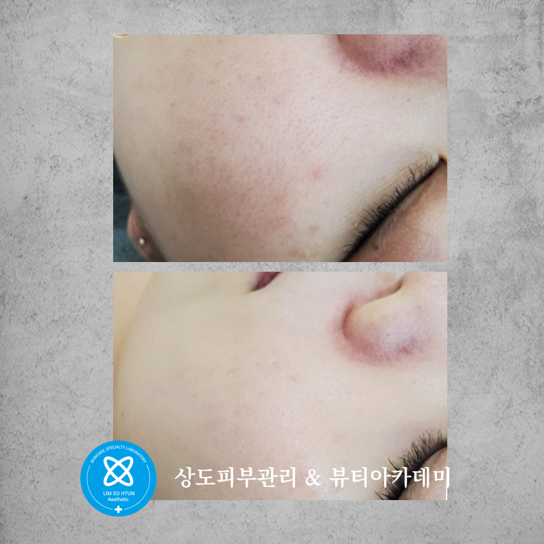 임소현 피부관리 대표 이미지