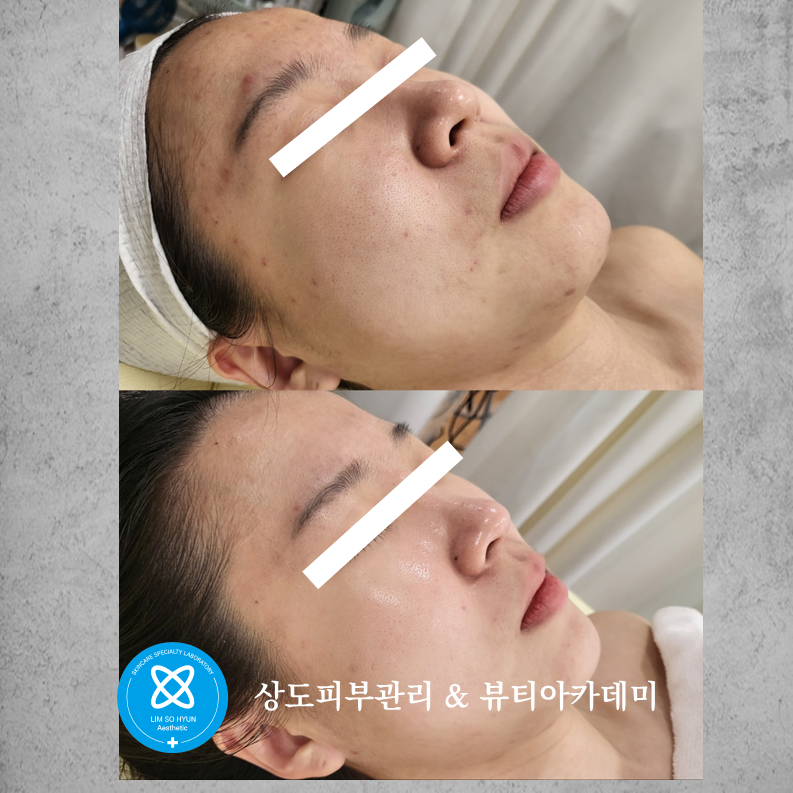 임소현 피부관리 대표 이미지