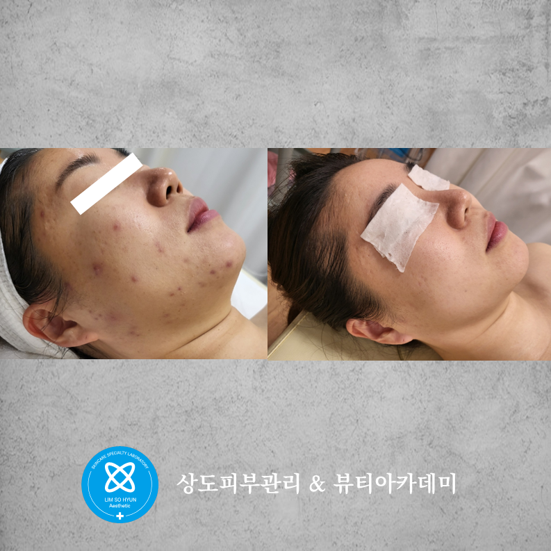 임소현 피부관리 상도점 대표 이미지