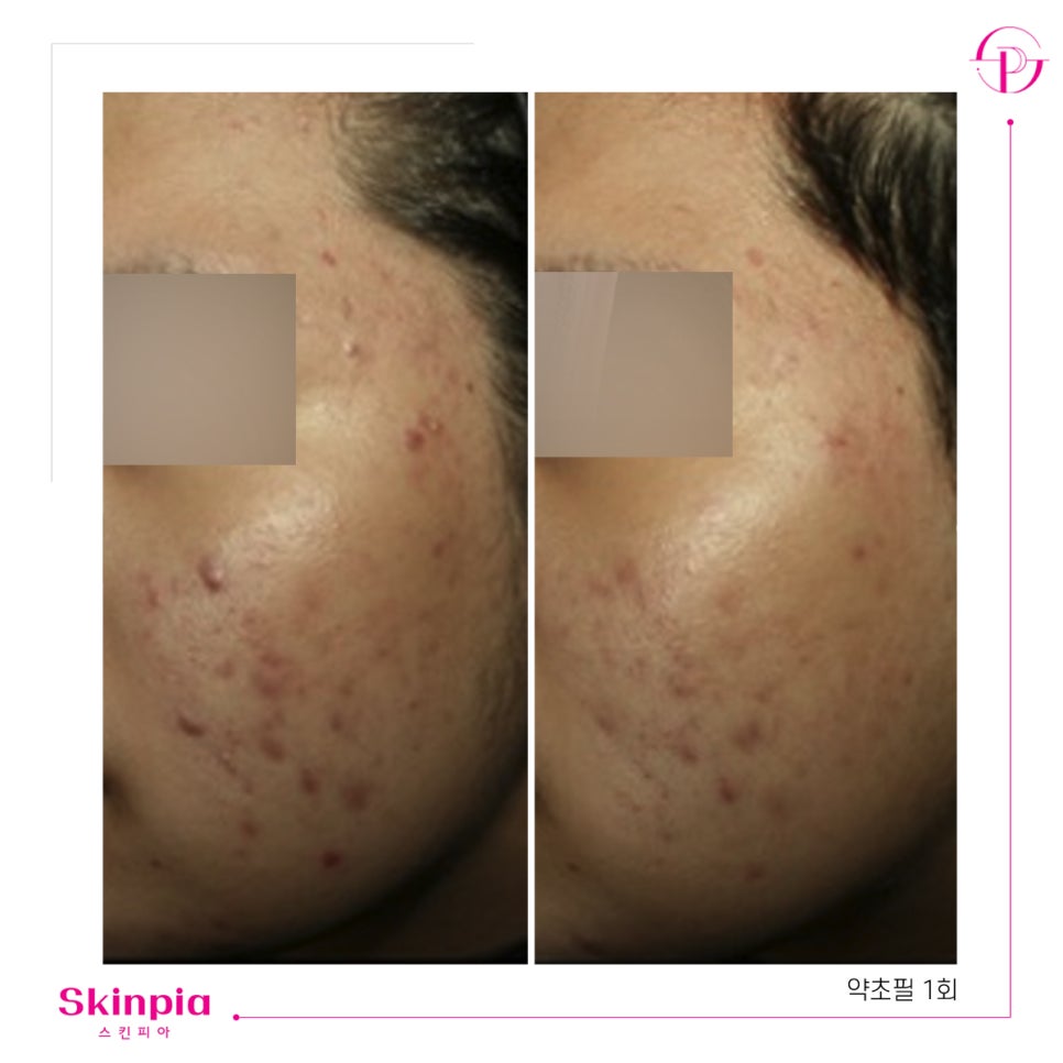 스킨피아 대표 이미지