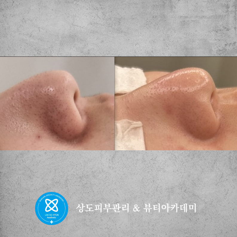 임소현 피부관리 상도점 대표 이미지