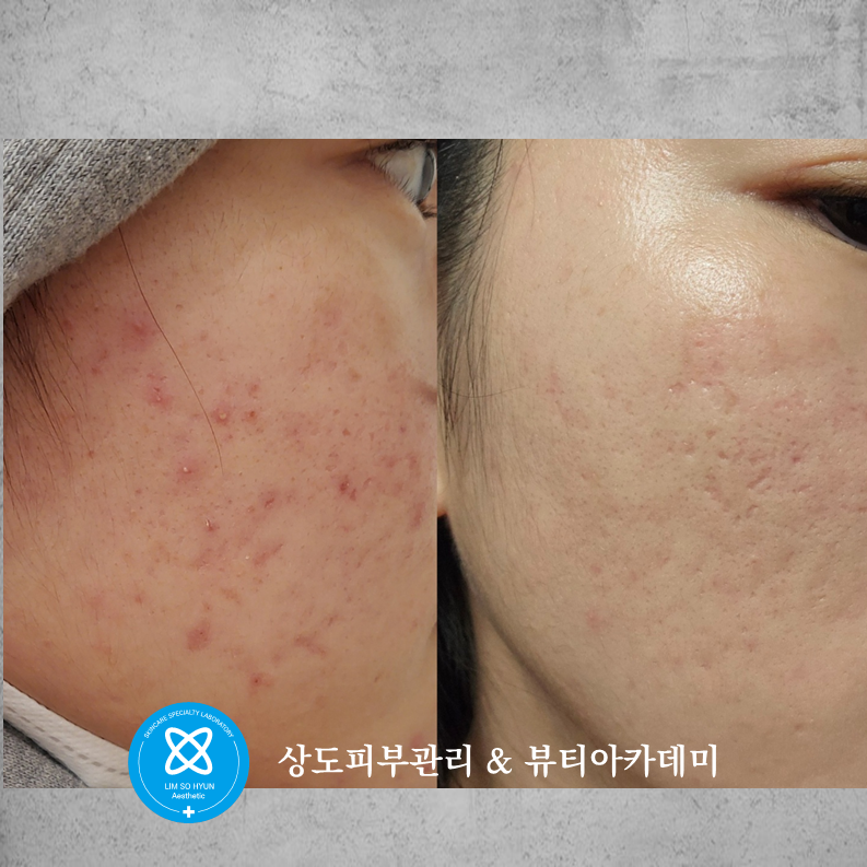 임소현 피부관리 상도점 대표 이미지