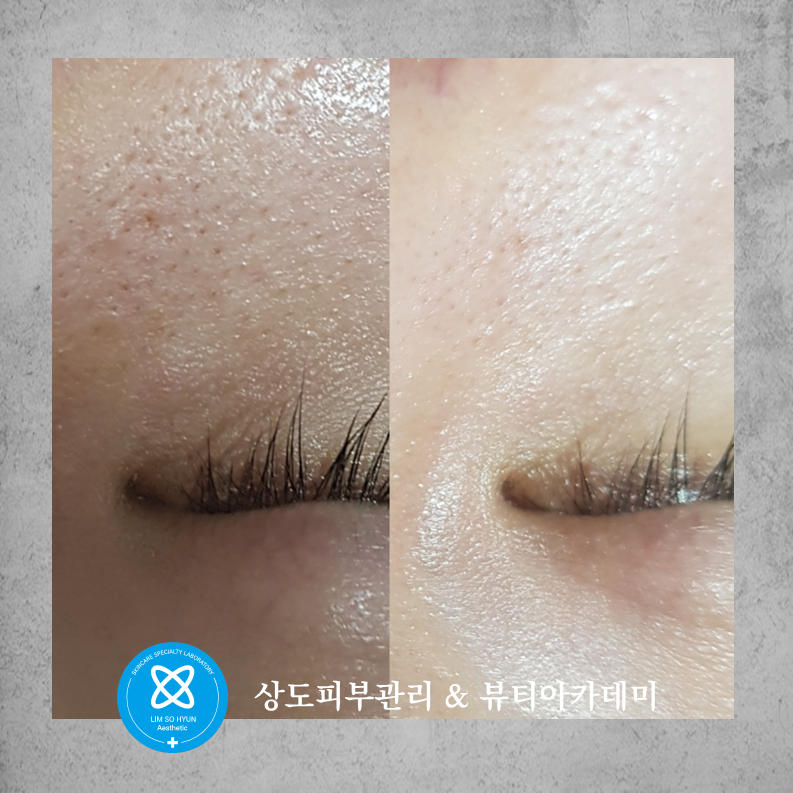 임소현 피부관리 상도점 대표 이미지