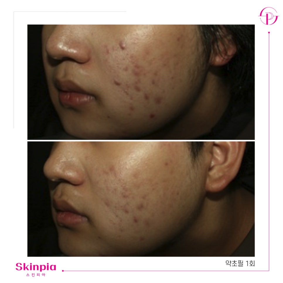 스킨피아 대표 이미지