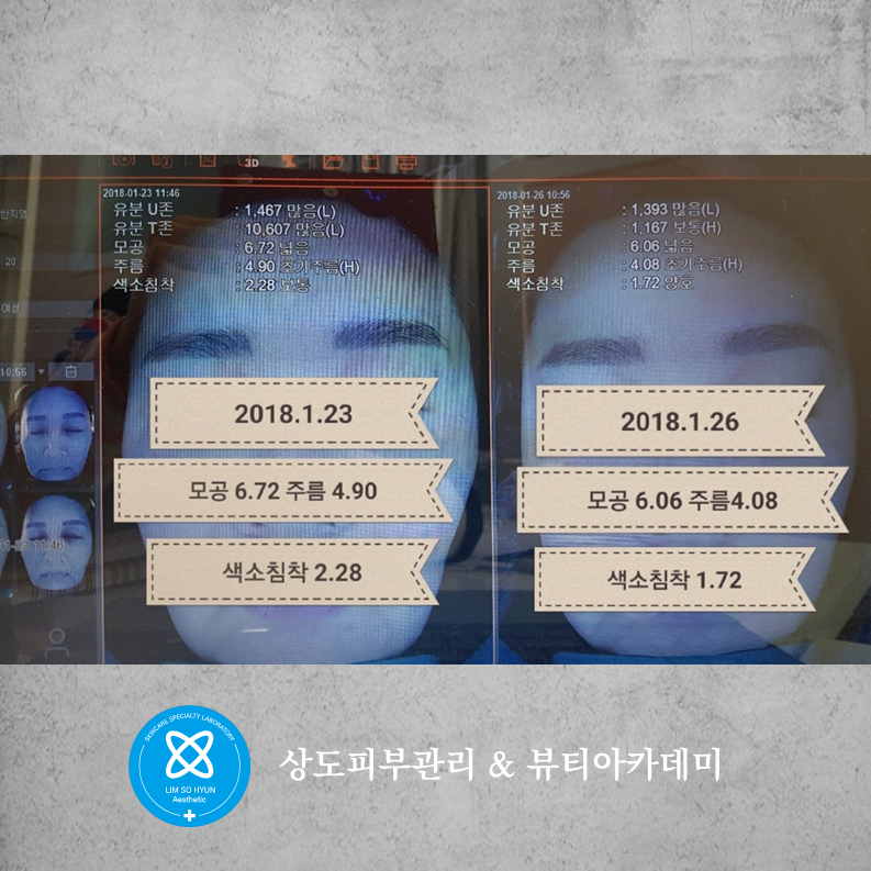 임소현 피부관리 대표 이미지