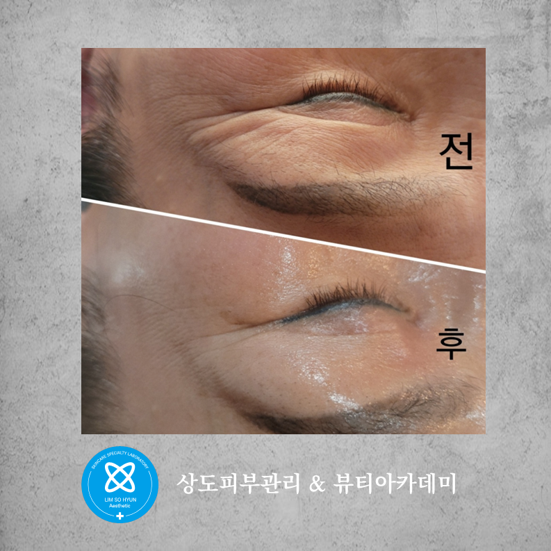 임소현 피부관리 여드름홍조&얼굴비대칭&안면윤곽 상도점 대표 이미지