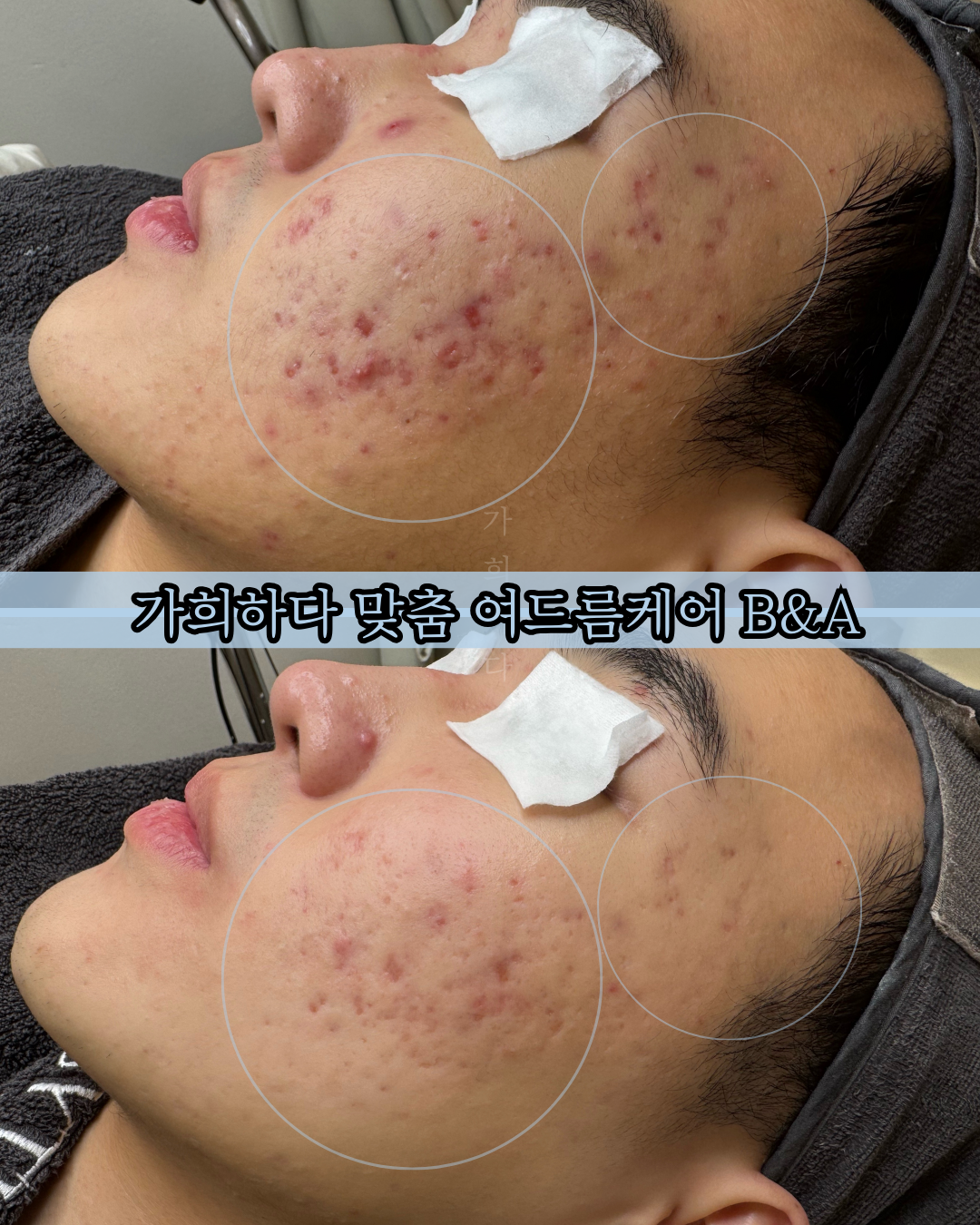 가희하다 잠실 대표 이미지