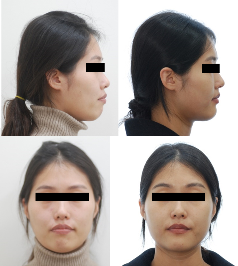 좋은이웃치과의원 대표 이미지