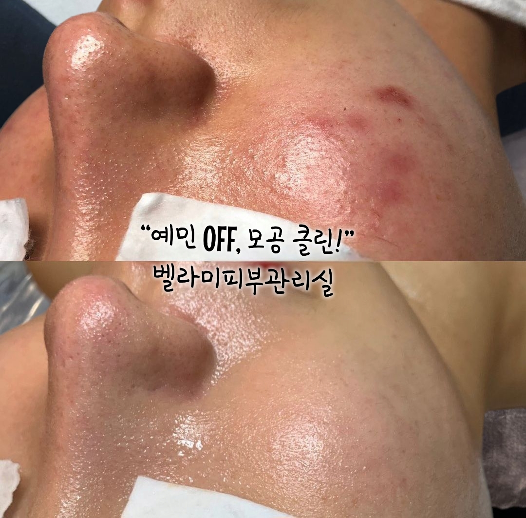 벨라미 대표 이미지