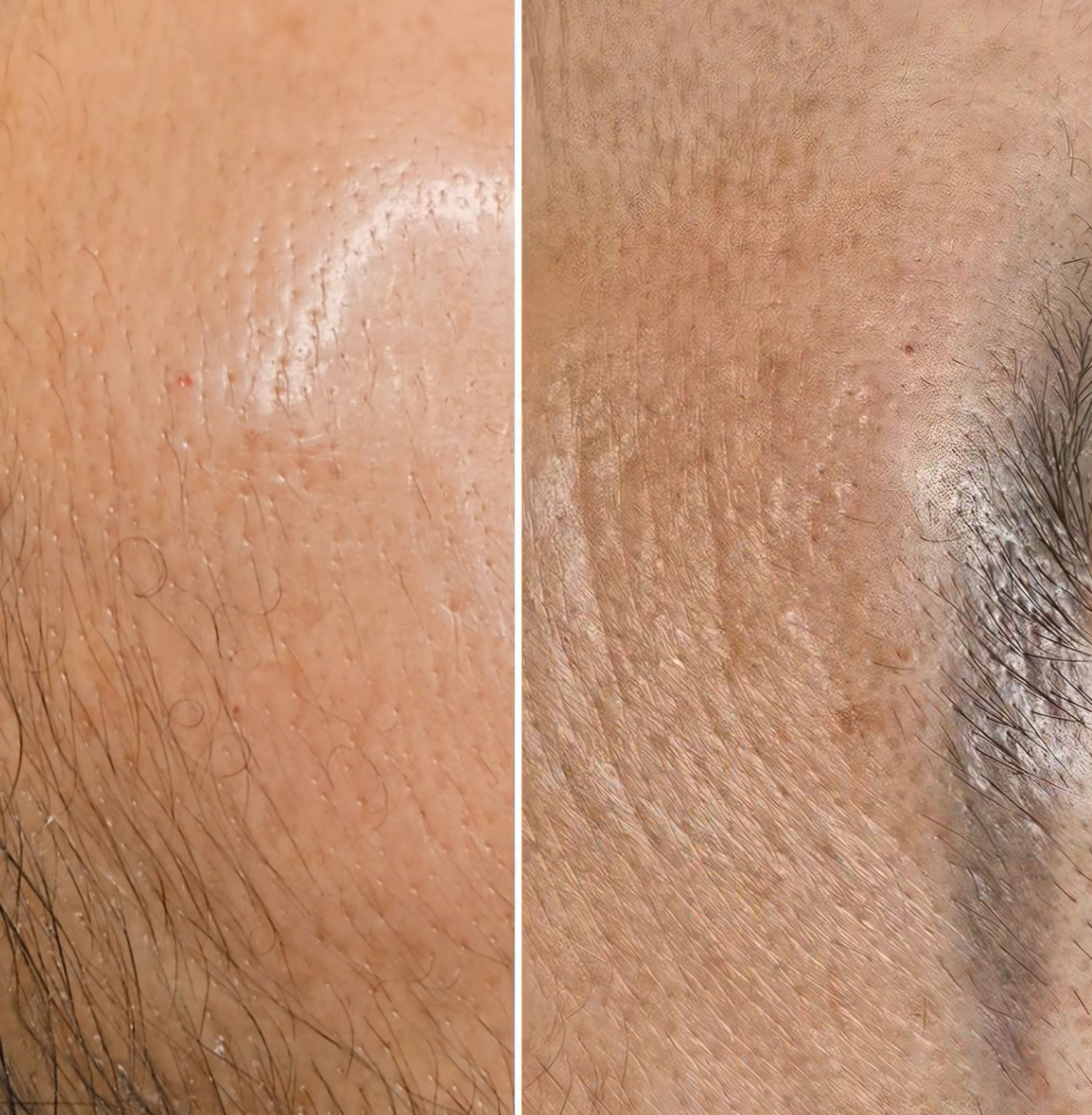 랄라뷰티 대표 이미지