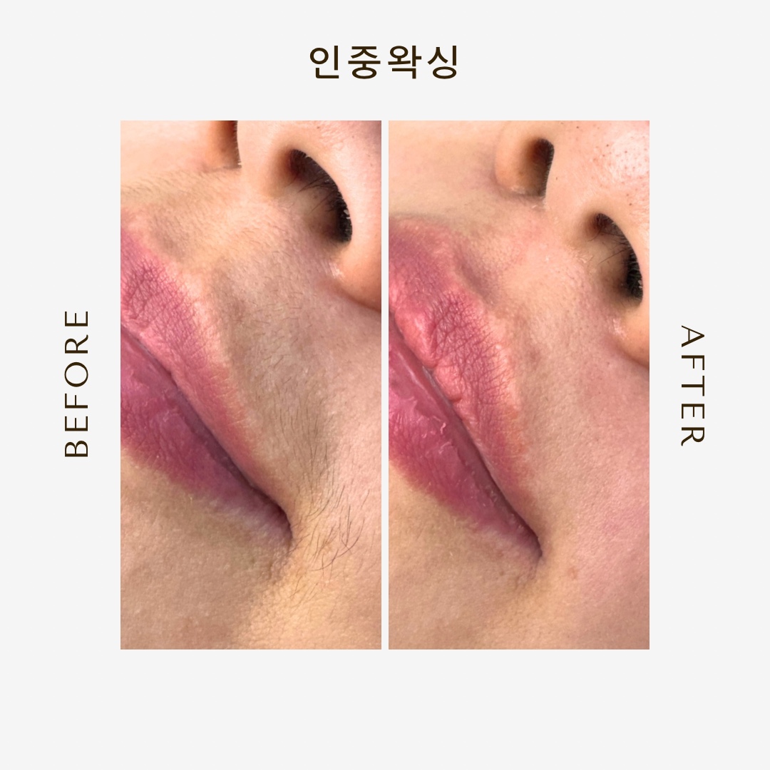 피부엔바디