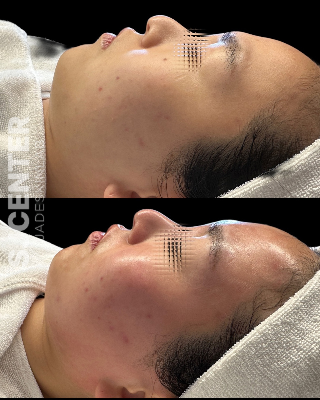 제이드스킨랩 대표 이미지