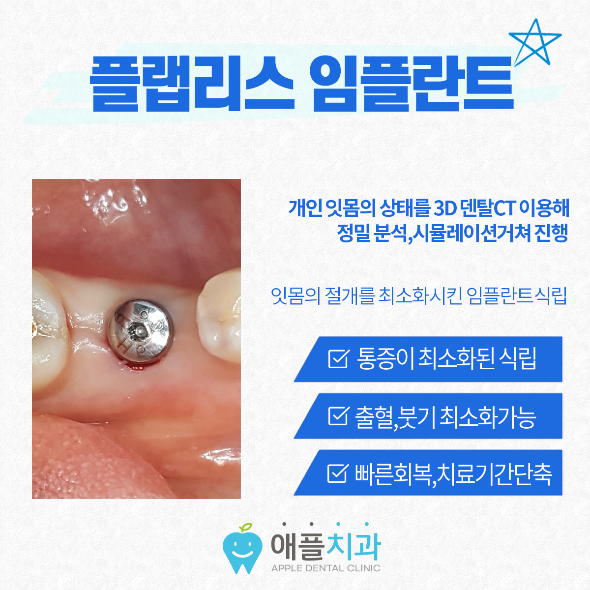 애플치과의원