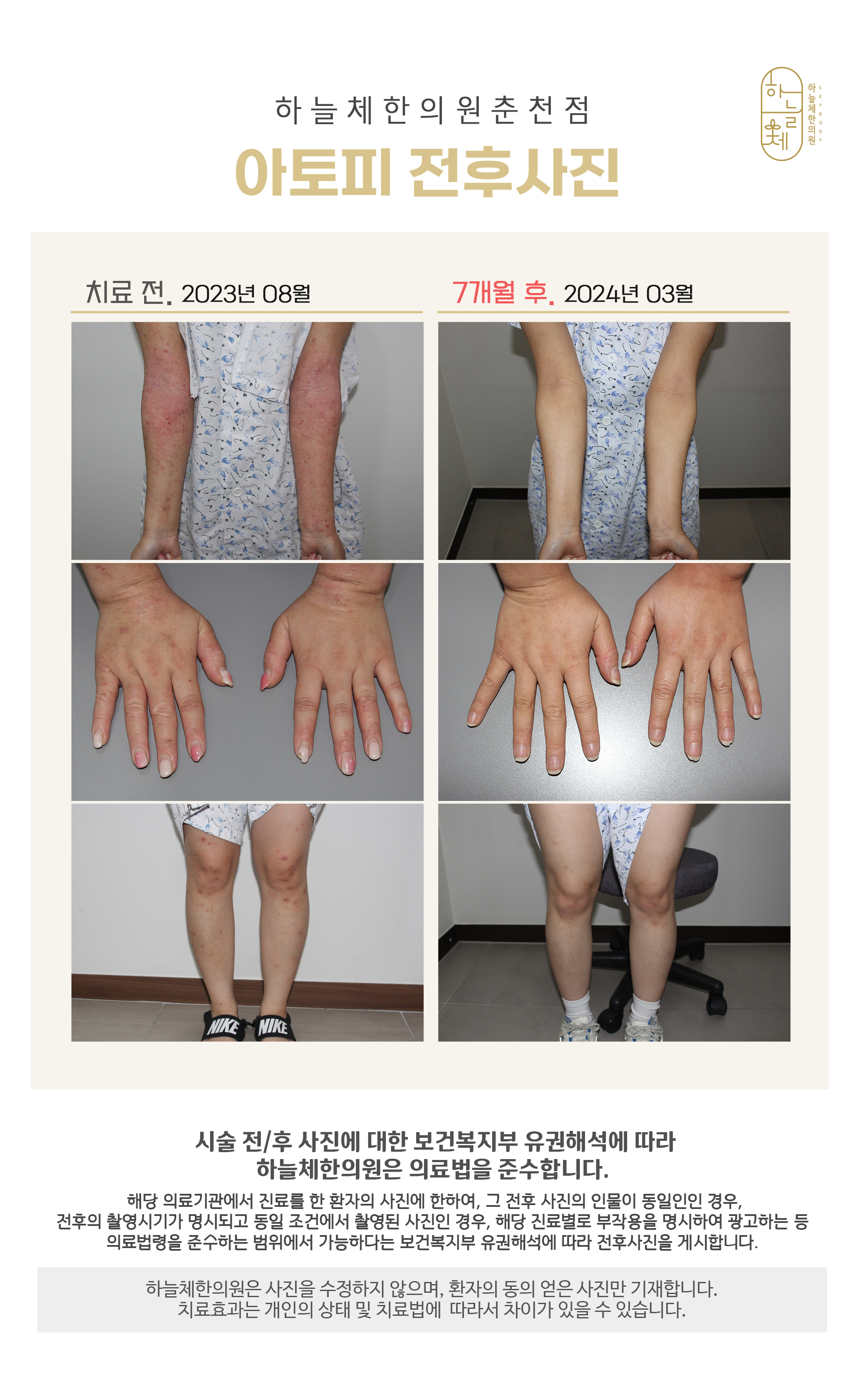 하늘체한의원 춘천 대표 이미지