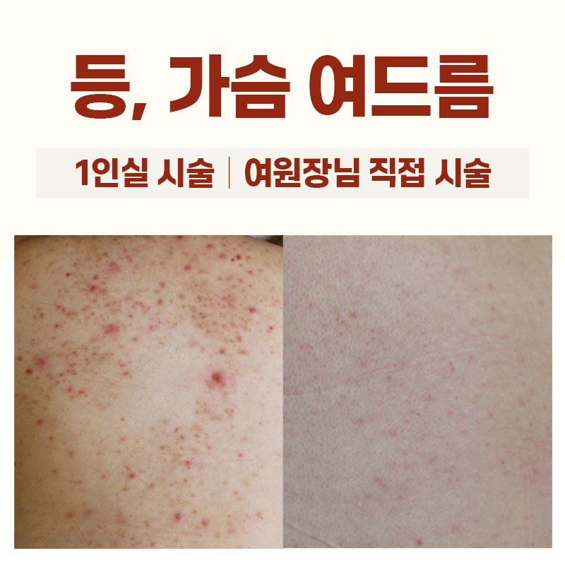 존스킨한의원 영등포 대표 이미지