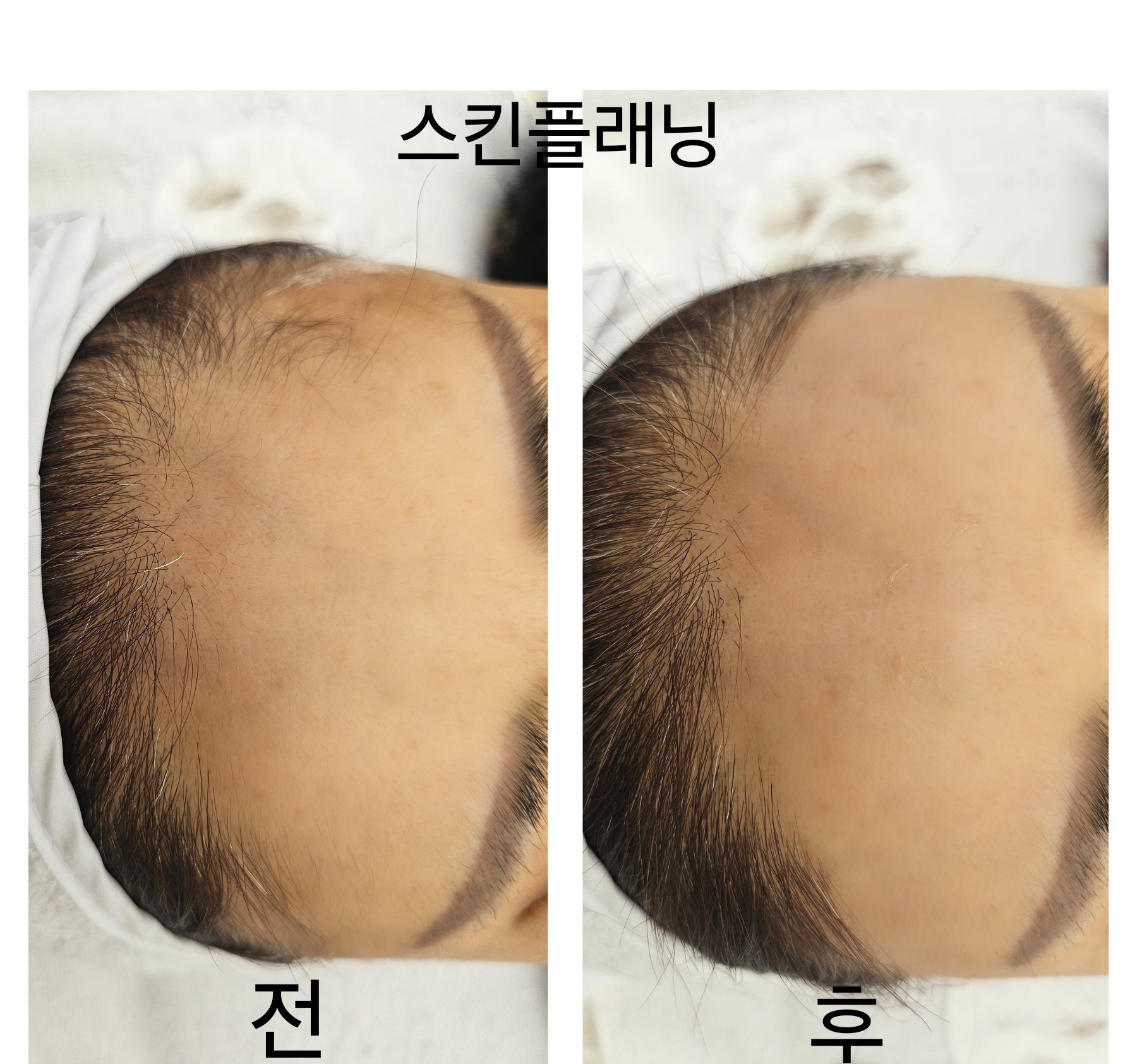 오로시 피부 장현점 photo 8