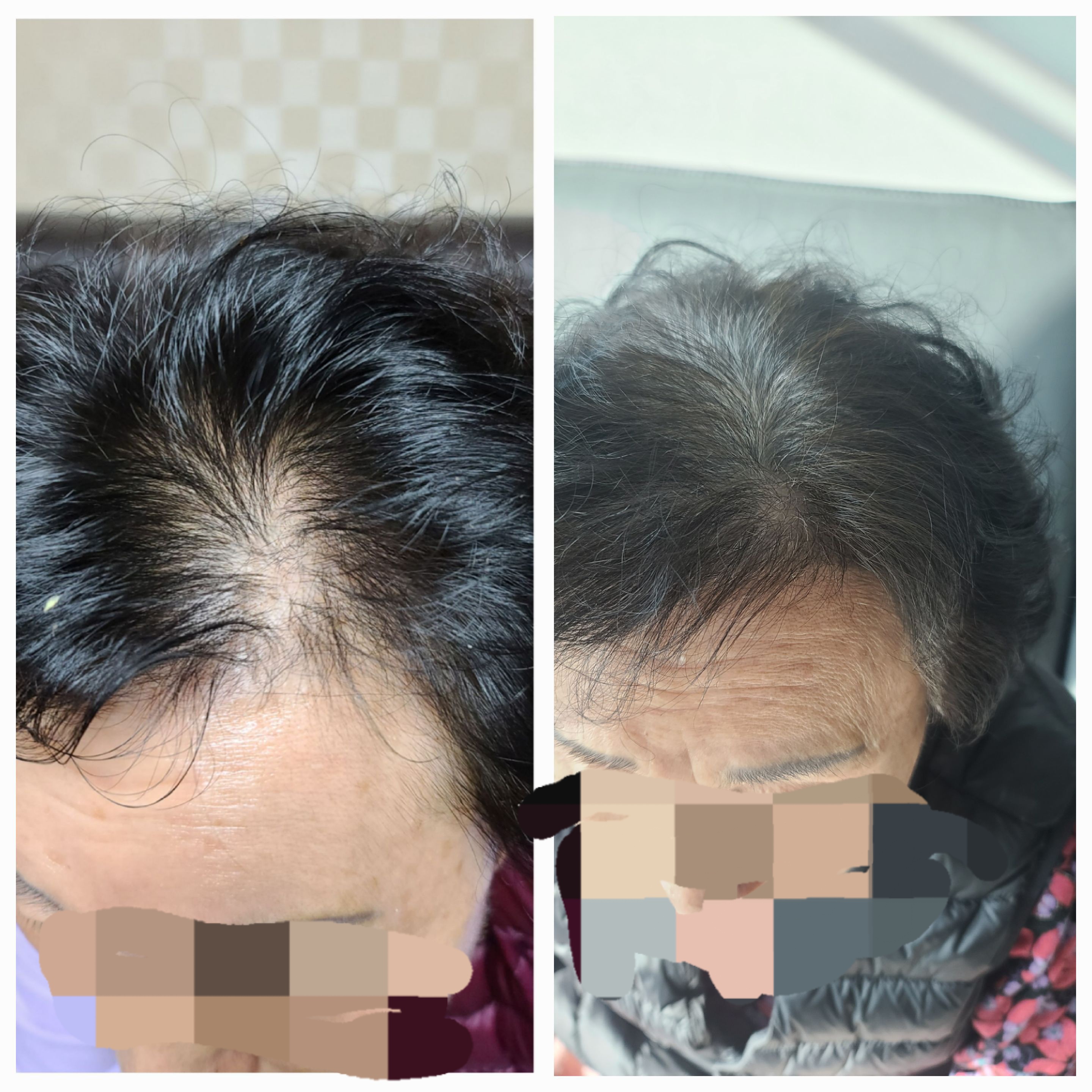 샤론헤어
