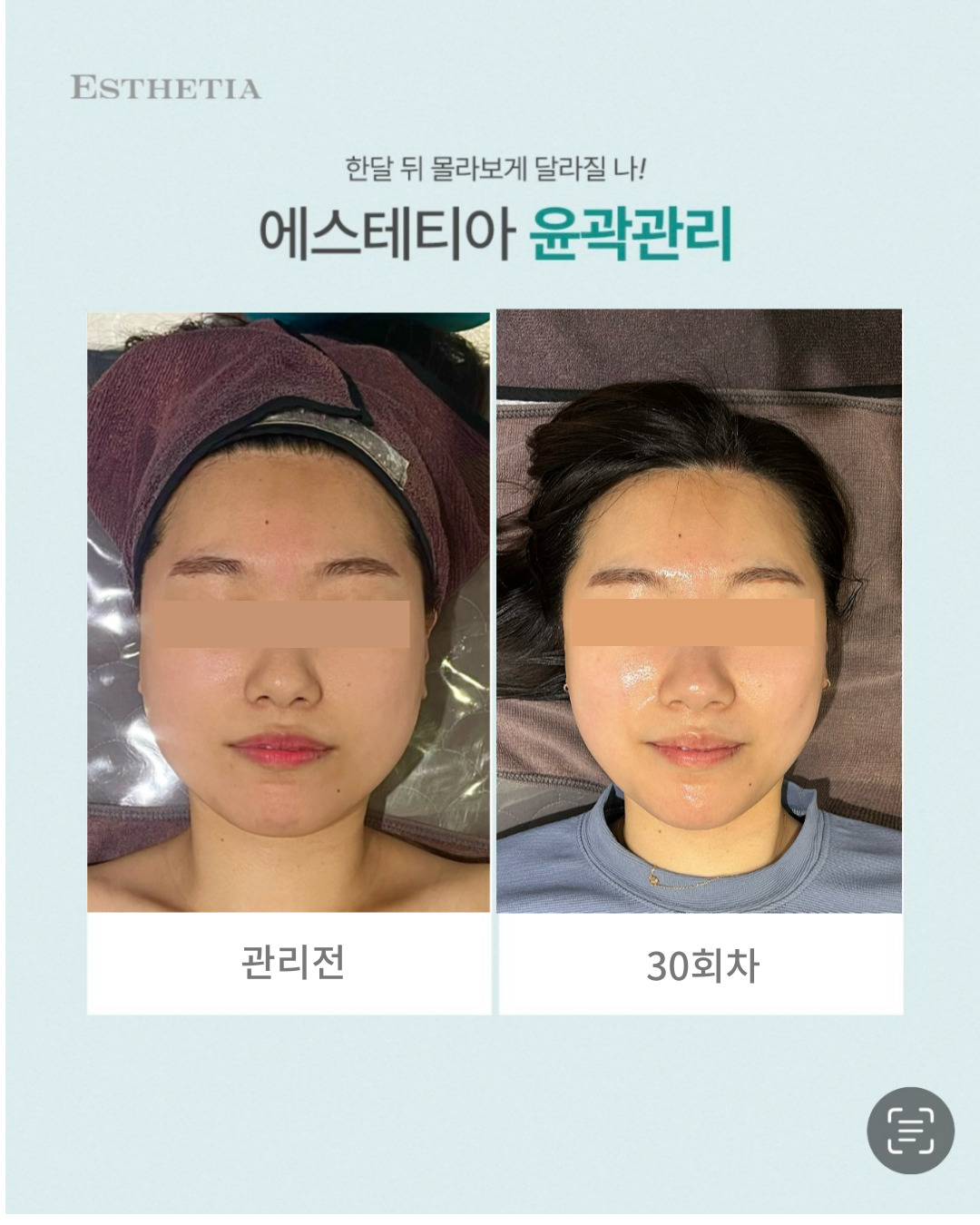 에스테티아 청라1호점 photo 4