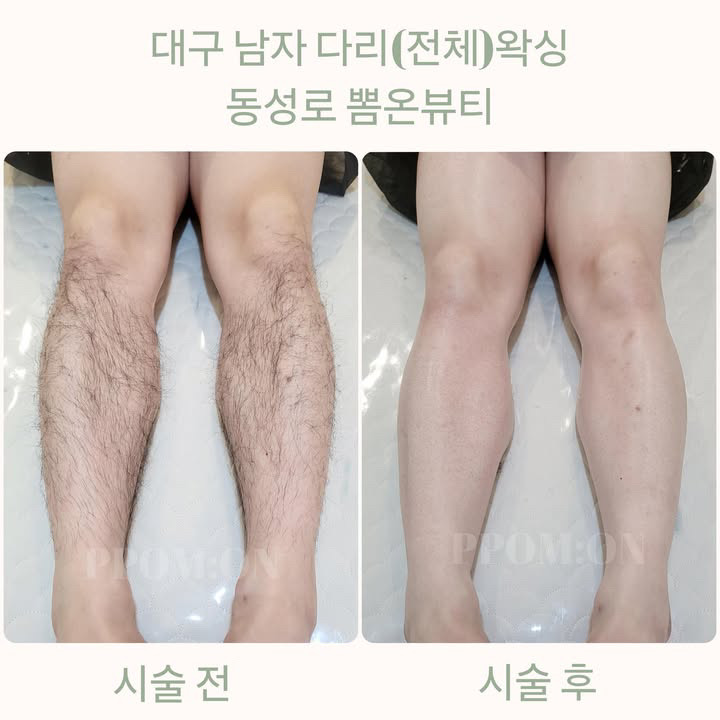 뽐온뷰티 대구본점