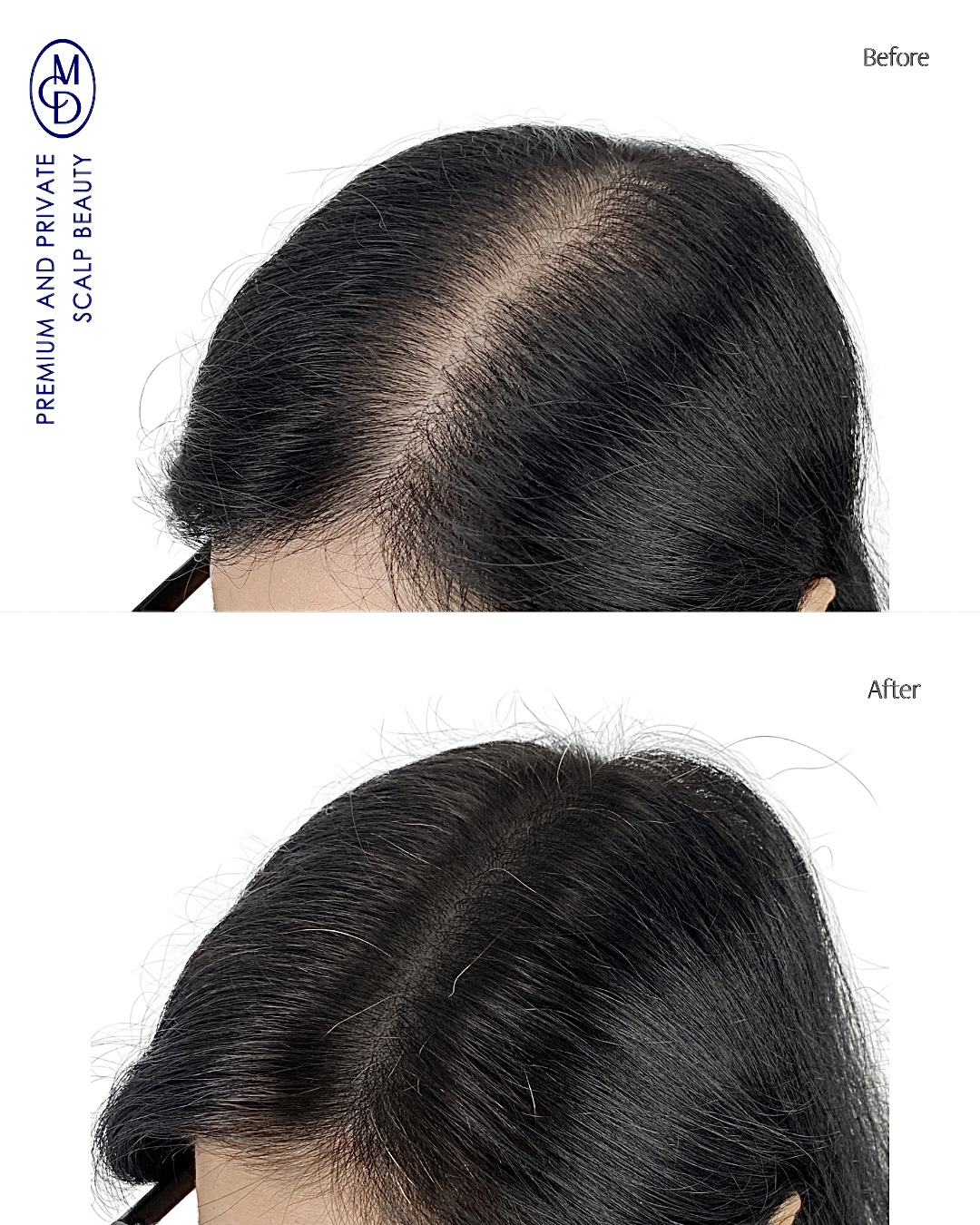 탈모왕 광주점 대표 이미지