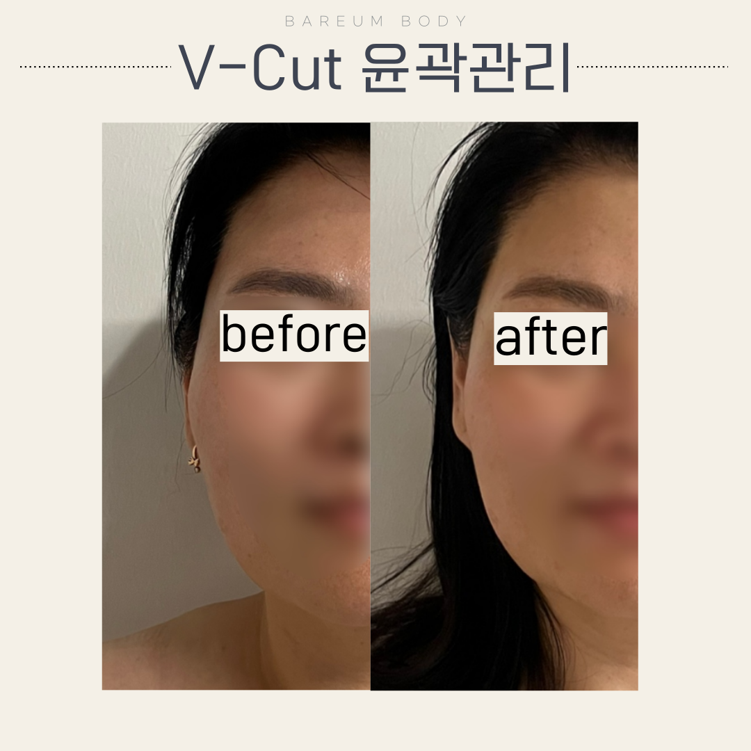 바름바디케어