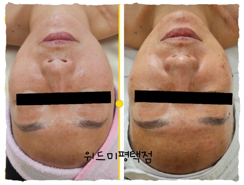 위드미 평택점