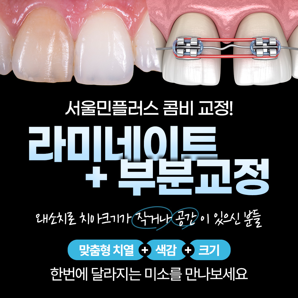 서울민플러스치과의원 대표 이미지