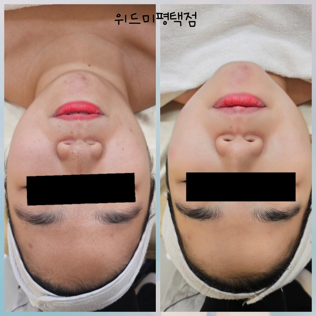 위드미 평택점