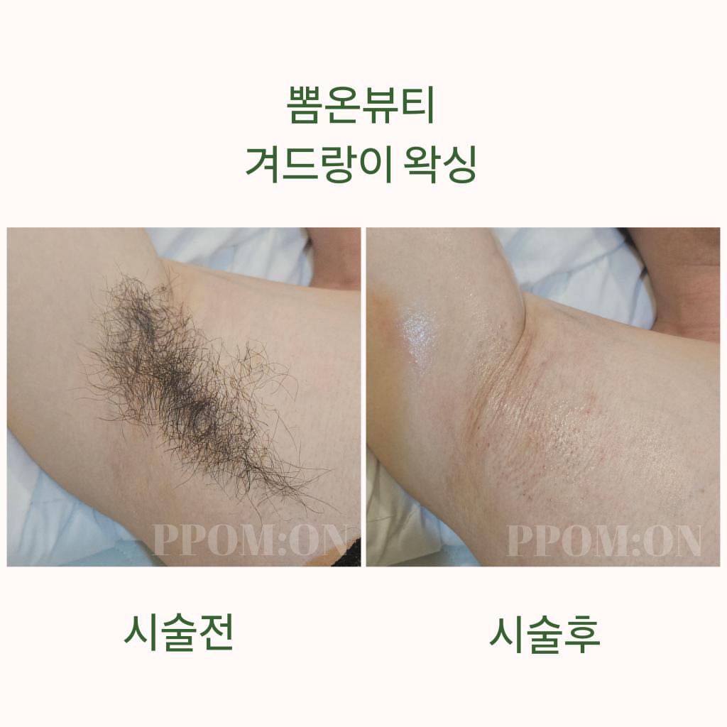뽐온뷰티 대구본점