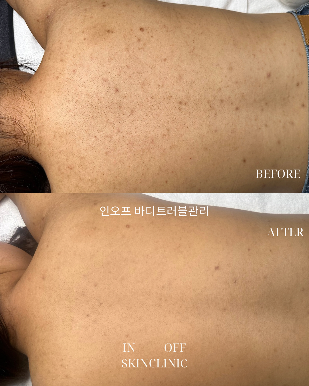 인오프 대표 이미지