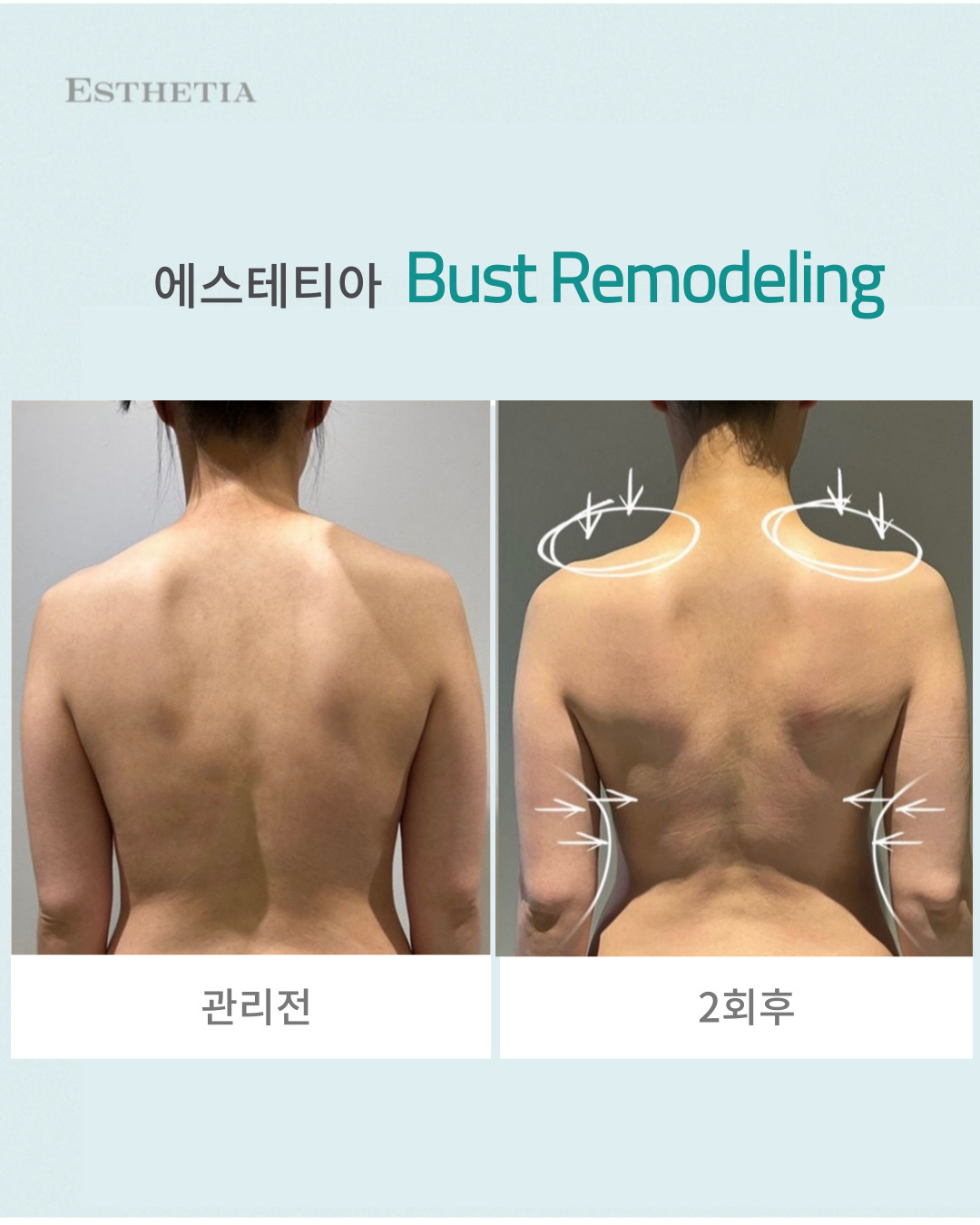에스테티아 청라1호점 photo 5