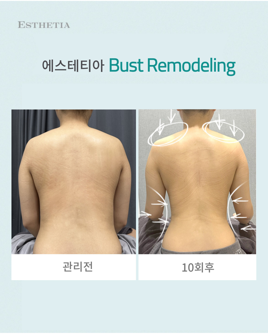 에스테티아 청라1호점 photo 3