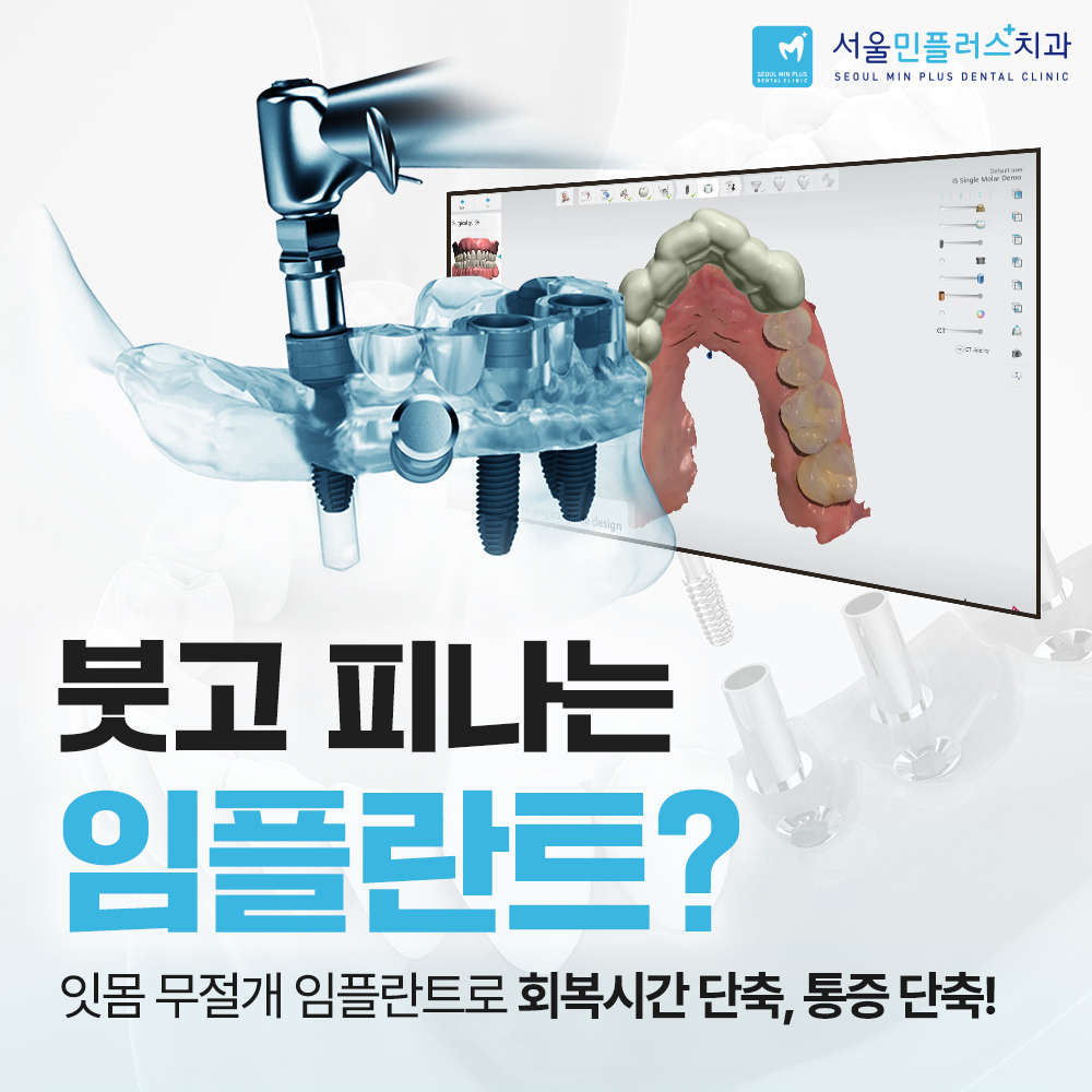 서울민플러스치과의원 이미지