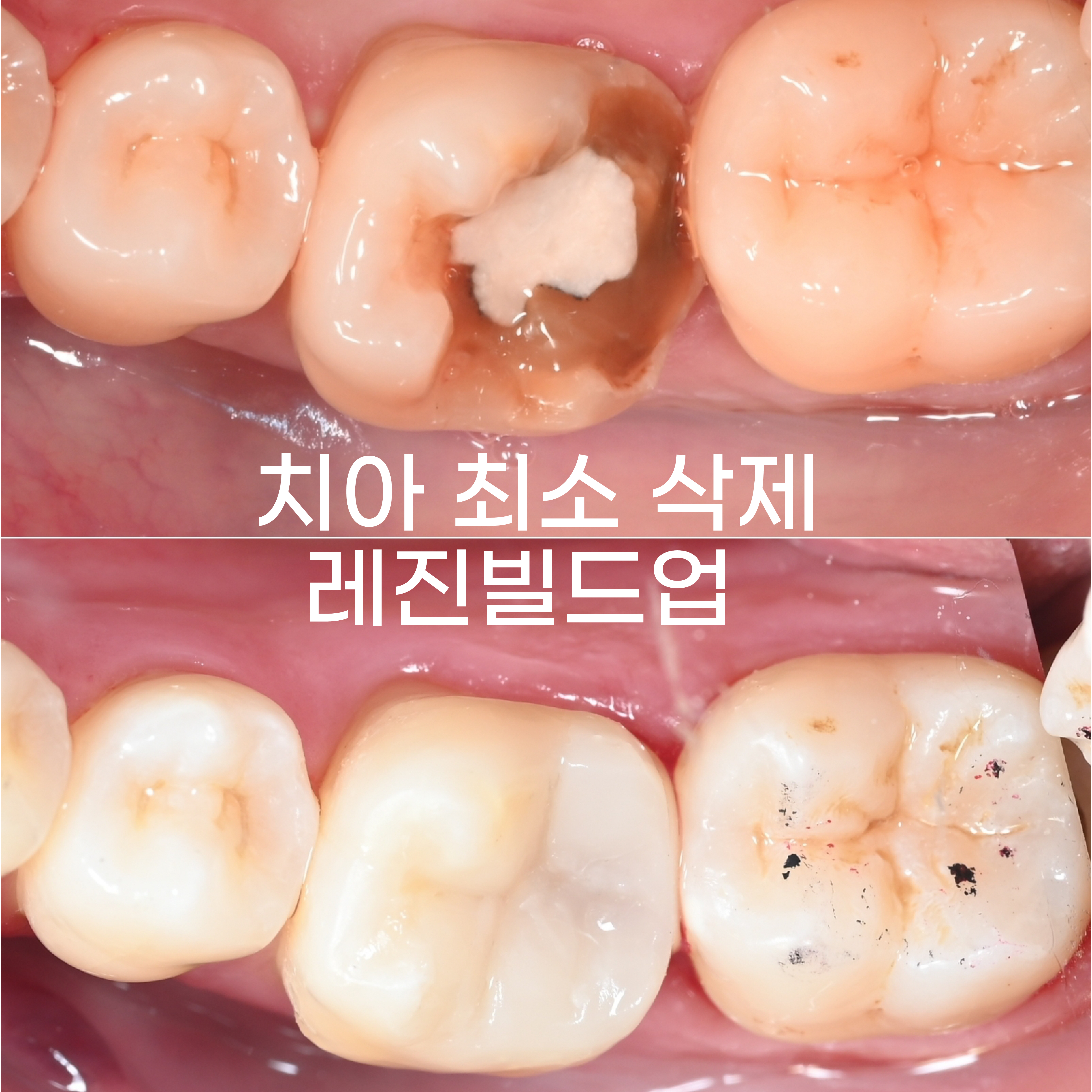 연세일등치과 이미지