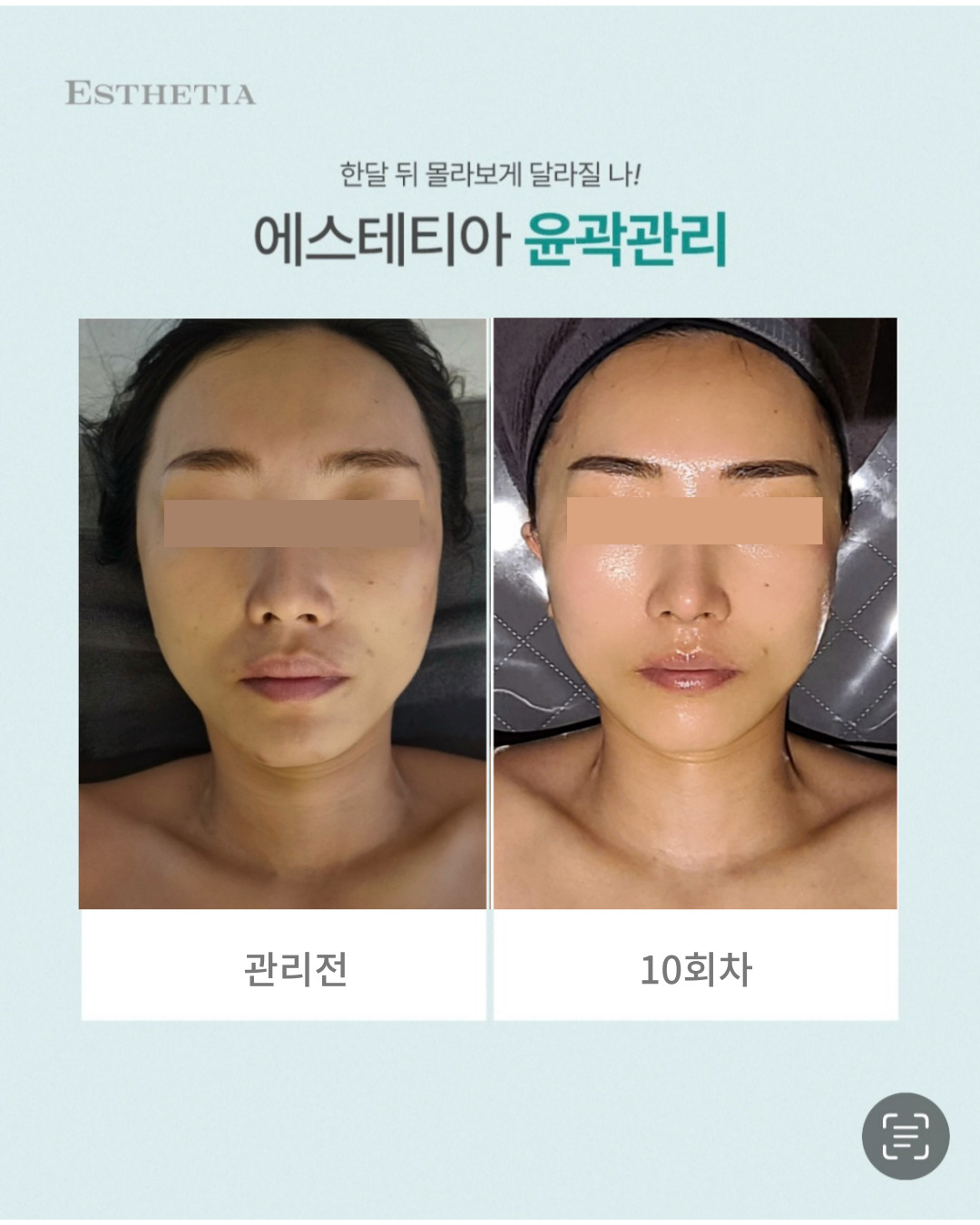 에스테티아 청라1호점 photo 2