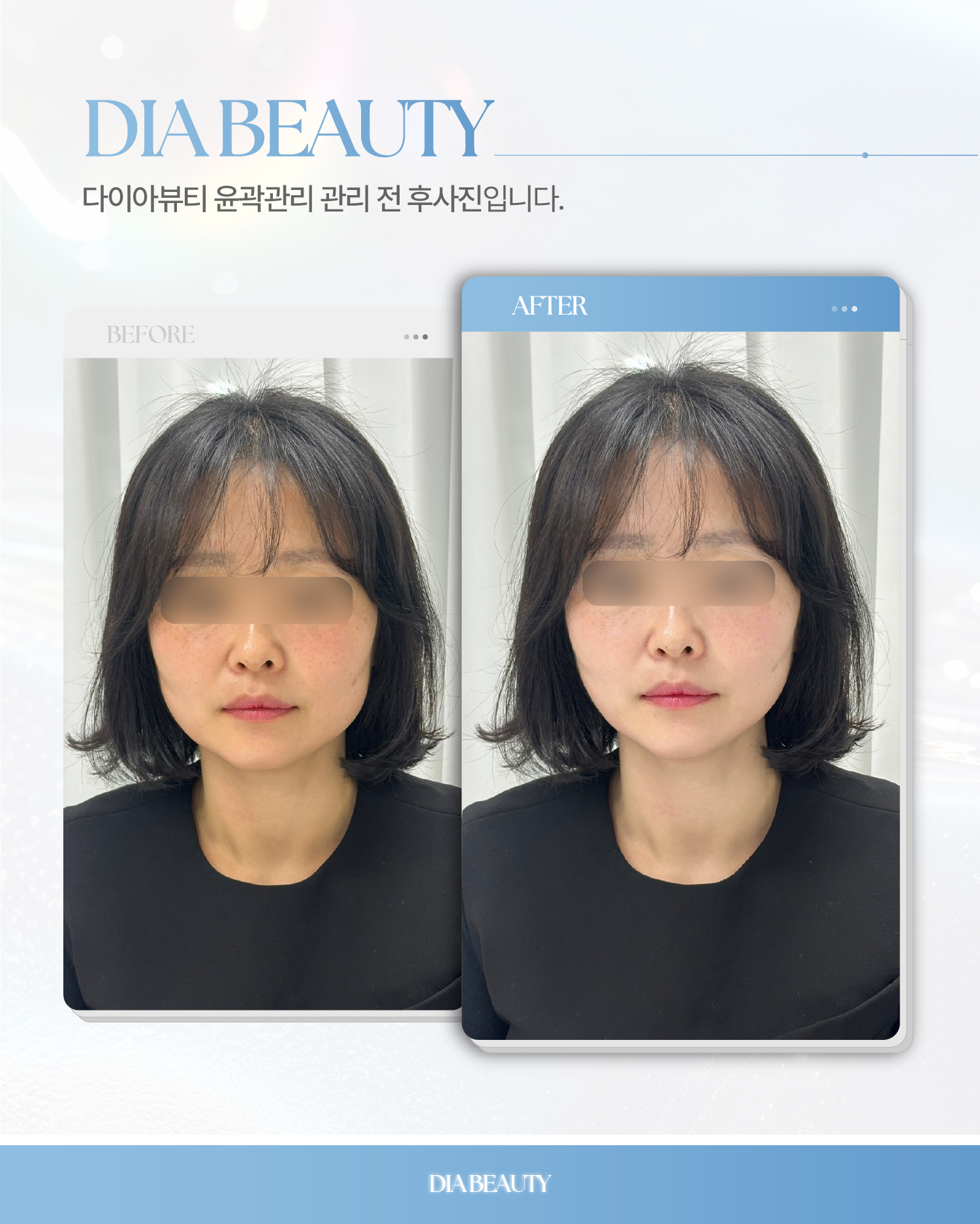 다이아뷰티 광주첨단점
